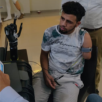 upper-extremity-prosthetics